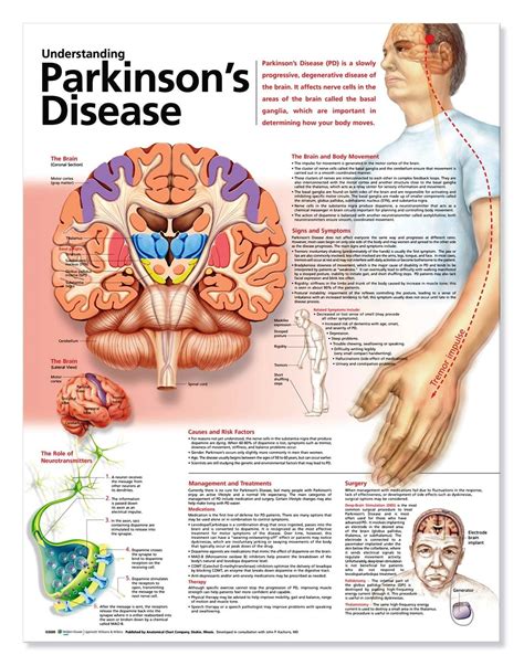 Know Everything About Parkinsons Disease Indianmedtrip Parkinsons