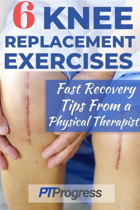 Knee Replacement Exercises To Do After Surgery