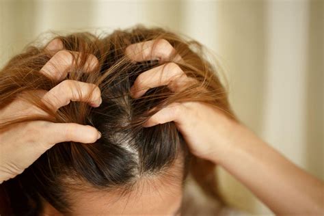Dandruff Vs Dry Scalp 2023 Guide Differences Causes And Solutions