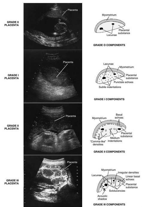 Obstetric Ob Ultrasound Made Easy Step By Step Guide Artofit