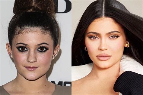 All The Kardashian Jenners Plastic Surgery Procedures Girlfriend