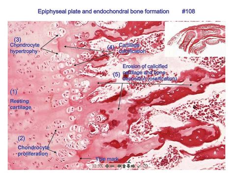 The Epiphyseal Plate A Layer Of Cartilage That Separates The Growing