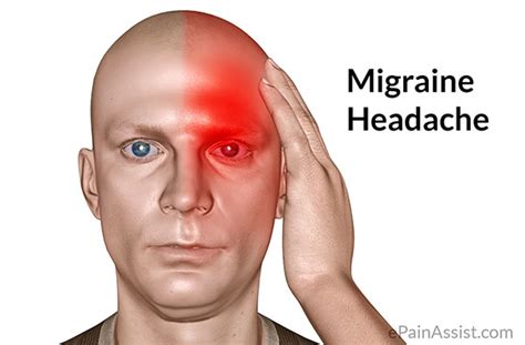Dealing With Migraines Migraine Health