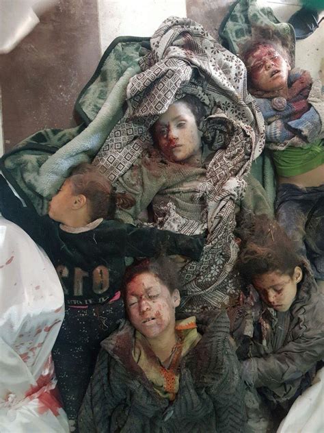 Filmy Z Wojny Na Ukrainie - Wojna w Syrii. Drastyczne zdjęcie ofiara rosyjskich ataków