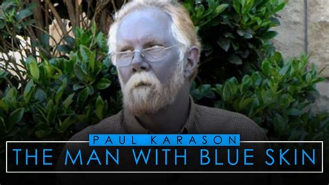 Paul Karason The Man With Blue Skin Youtube