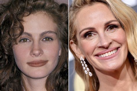 Did Julia Roberts Get Plastic Surgery Including Lips And Nose Job Famous Plastic Surgeries
