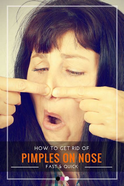 How To Get Rid Of Pimples On The Nose Healthy Lifestyle