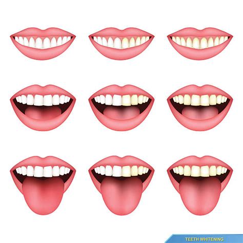 Royalty Free Missing Tooth Clip Art Vector Images And Illustrations Istock