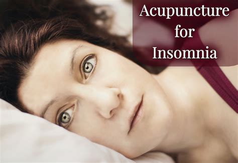 Fascinating Research On Acupuncture Treatment For Insomnia Acupuncture Continuing Education