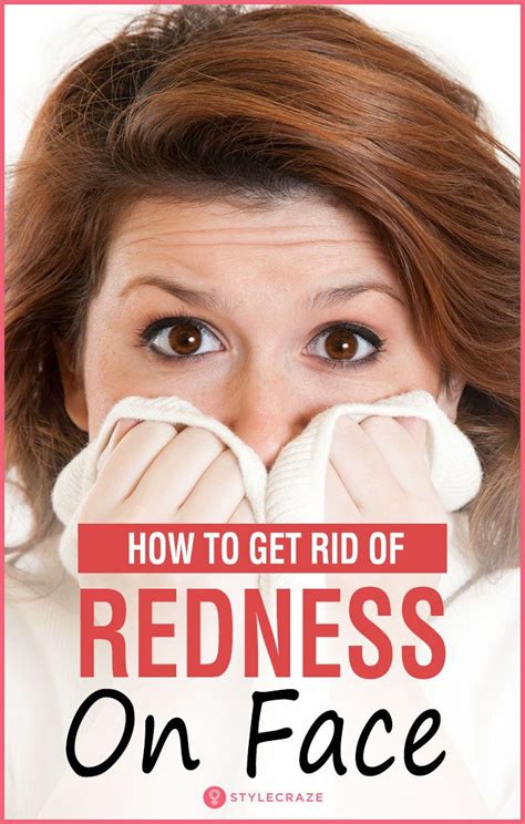 Home Remedies To Get Rid Of Redness On The Face Redness On Face Get