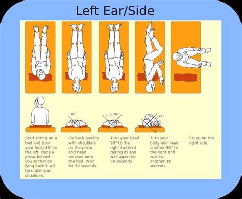 Pin By Alekseevelisei On Health Epley Maneuver Vertigo Treatment