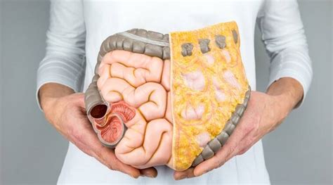 Colon Infection Everything You Need To Know About It Health News