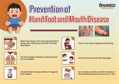 Hand Foot And Mouth Disease Brief Information And Prevention Unimed