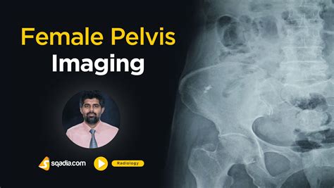 Female Pelvis Imaging Radiology Anatomy V Learning