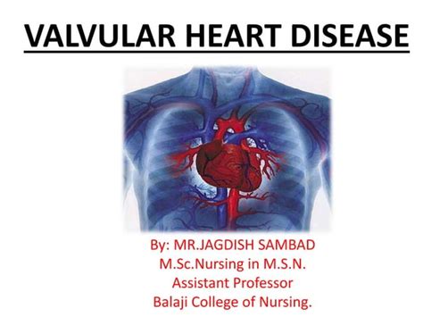 Valvular Heart Disease Ppt