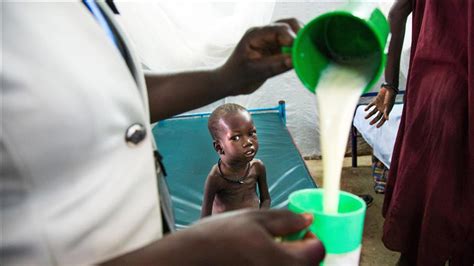 Drc 770000 Children Suffer From Acute Malnutrition