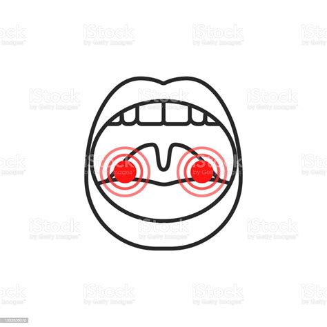 Open Mouth Thin Line Icon Tonsillitis Stock Illustration Download