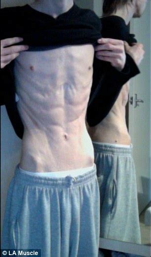 Anorexic Guys