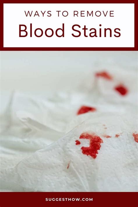 How To Remove Blood Stains Easy And Simple Ways