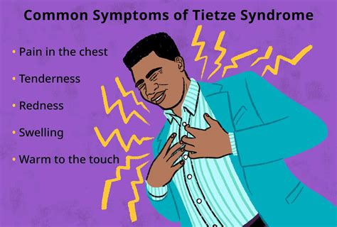 Tietze Syndrome Signs Symptoms And Complications