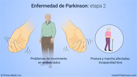 Entendiendo La Enfermedad De Parkinson