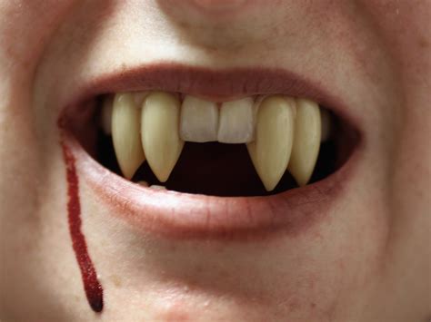 How To Get Vampire Teeth For Real Bloodlust Fx Fangs