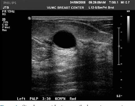Figure 1 From The Sonographic Findings And Differing Clinical