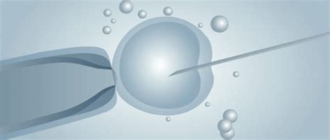Donor Egg Ivf In The Czech Republic