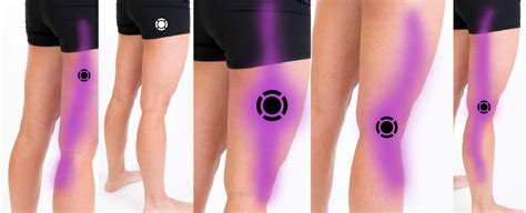 Lateral Knee Pain Komizo Diagnostics