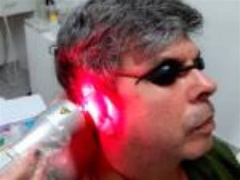 Terapia a laser é alternativa para tratamento de zumbido do ouvido