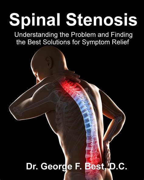 Buy Spinal Stenosis Understanding The Problem And Finding The Best