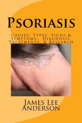Pdf⋙ Psoriasis Psoriasis Causes Types Signs And Symptoms Diagnosis