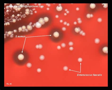 Enterococcus Faecalis Compared With Staphylococcus Aureus On Blood Agar
