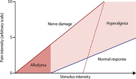 References In Allodynia And Hyperalgesia In Neuropathic Pain Clinical