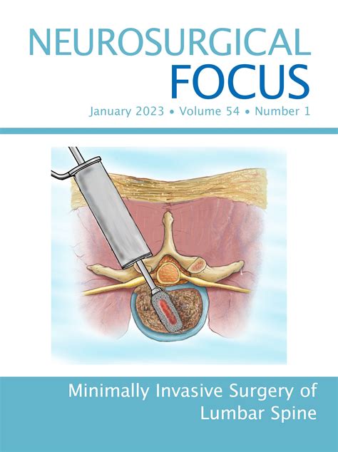 Letter To The Editor Endovascular Treatment For Low Grade Brain Avm In Neurosurgical Focus