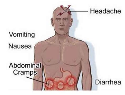 Symptoms of the plague typically appear within one week of exposure. Africa risks pneumonic plague, spread through coughing ...