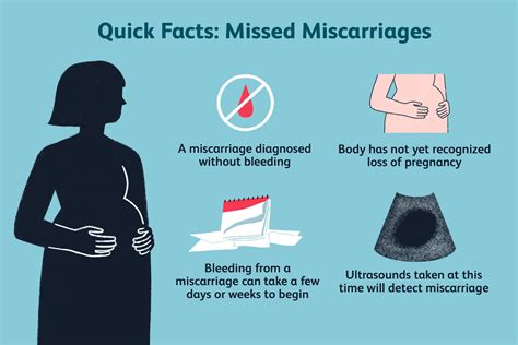 Miscarriage Treatment Weeks Understanding Options And Care Health Hiway
