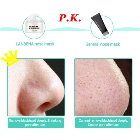 Maybe you would like to learn more about one of these? Blackhead Remover Skin Care Cream Deep Clean Removal ...