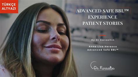 The Advanced Safe Bbl Experience Patient Stories Anna Lisa Herascu Dr Karaaltin Youtube