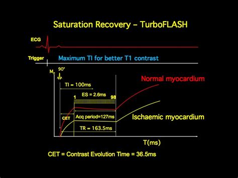 Mri Blog Pulse Sequences For Cardiac Mri