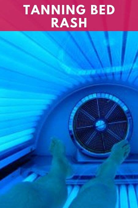 Tanning Bed Rash How To Prevent The Bumps And How To Fix Them Luxe