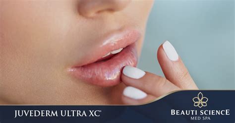 Juvéderm Ultra Xc Lip Filler Treatment In Plano Beauti Science Med Spa