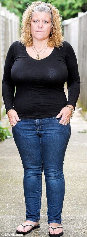 Mother Who Had M Size Chest Is Refused NHS Breast Reduction Op