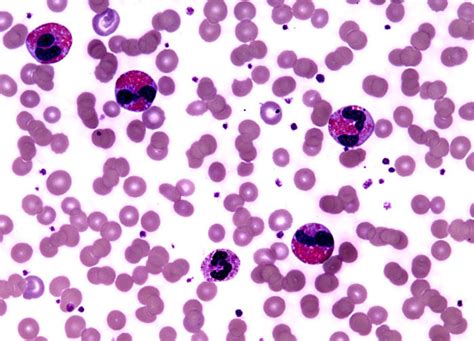 Blood Histology Eosinophil Histology Slide