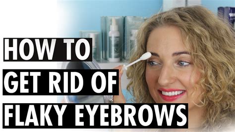 How To Get Rid Of Flaky Eyebrows Youtube
