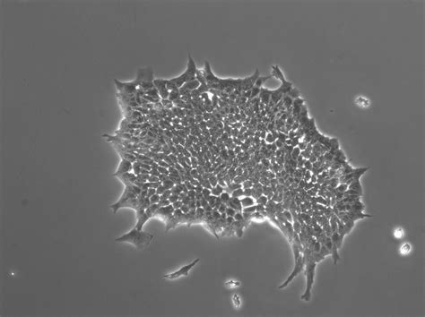 Ronin Masterless Samurai Protein Preserves Stem Cells National