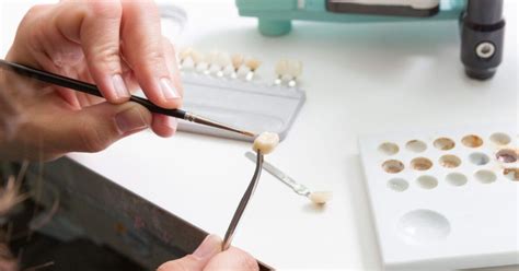 Single Dental Implants Costs Benefits Ddi Dorset