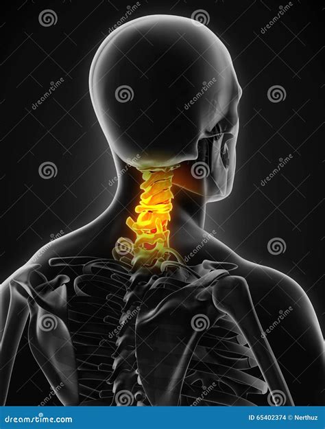 Painful Cervical Spine Stock Illustration Illustration Of Medical