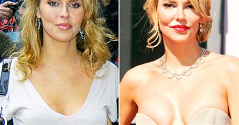 Brandi Glanville Real Housewives Plastic Surgery See Their Before And After Pictures Us