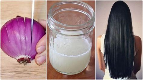 Correct Way Of Using Onion Juice For Hair Growth Onion Juice For Hair